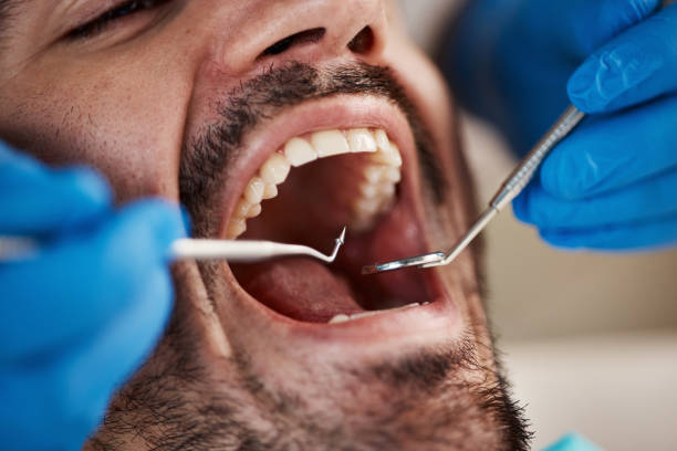 Best Full Mouth Reconstruction  in Huntsville, AL